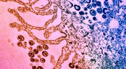 抗生素分子可使免疫系統(tǒng)殺死感染HIV的細胞