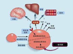研究表明 更年期會增加代謝綜合征的風(fēng)險(xiǎn)