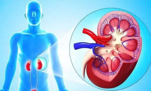 蛋白質可以提供糖尿病腎病的風險標志物和治療目標
