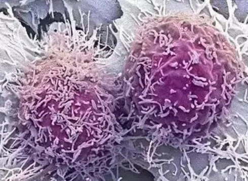 休斯頓大學研究人員探索睪丸激素在大腦中的作用