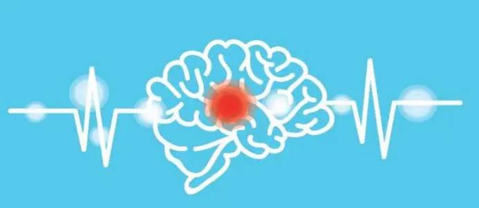 研究人員開發(fā)量化藥物治療計劃中認知功能障礙風險的新工具