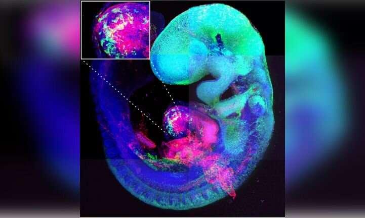 科學家發(fā)現(xiàn)一種可以修復先天性心臟缺陷的基因