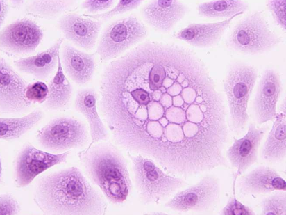 新研究使個(gè)性化免疫治療處方更近了一步