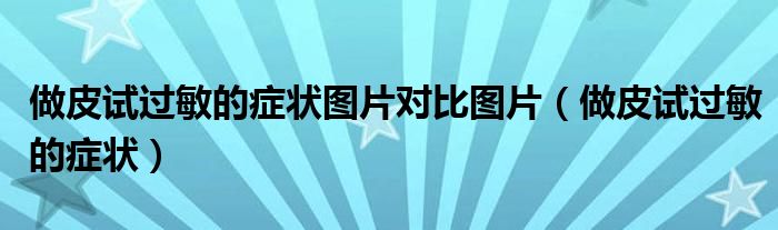 做皮試過(guò)敏的癥狀圖片對(duì)比圖片（做皮試過(guò)敏的癥狀）