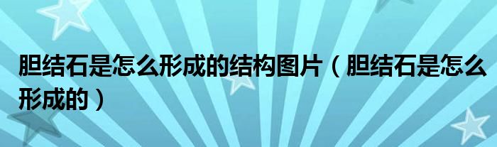 膽結(jié)石是怎么形成的結(jié)構(gòu)圖片（膽結(jié)石是怎么形成的）