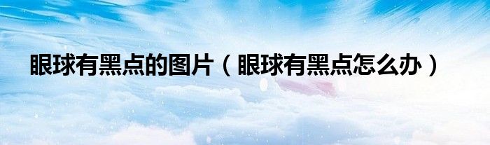 眼球有黑點(diǎn)的圖片（眼球有黑點(diǎn)怎么辦）