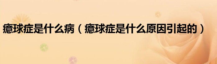 癔球癥是什么病（癔球癥是什么原因引起的）