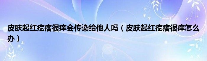 皮膚起紅疙瘩很癢會(huì)傳染給他人嗎（皮膚起紅疙瘩很癢怎么辦）