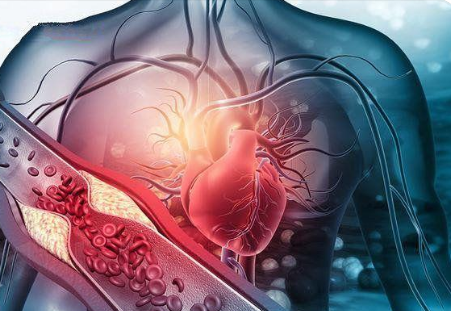 用于診斷單基因心血管疾病的CardioGen自動解釋系統(tǒng)