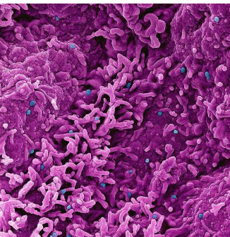 科學家開發(fā)小鼠模型來研究 mpox 毒力