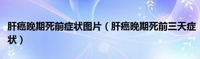 肝癌晚期死前癥狀圖片(肝癌晚期死前三天癥狀)