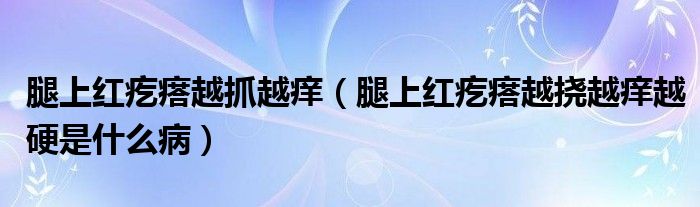 腿上紅疙瘩越抓越癢（腿上紅疙瘩越撓越癢越硬是什么?。?class='thumb lazy' /></a>
		    <header>
		<h2><a  href=