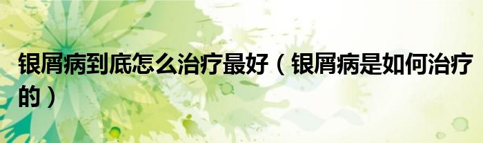 銀屑病到底怎么治療最好（銀屑病是如何治療的）