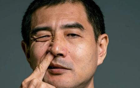 阿爾茨海默病：挖鼻孔和 5 種可導(dǎo)致癡呆的不健康習(xí)慣