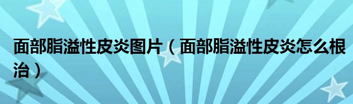 面部脂溢性皮炎圖片（面部脂溢性皮炎怎么根治）
