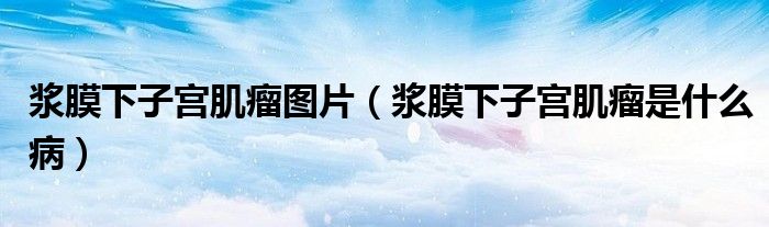 漿膜下子宮肌瘤圖片（漿膜下子宮肌瘤是什么?。?class='thumb lazy' /></a>
		    <header>
		<h2><a  href=