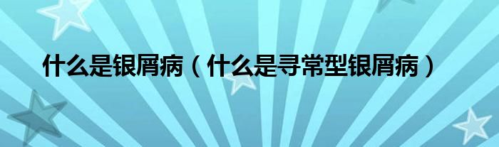 什么是銀屑?。ㄊ裁词菍こＰ豌y屑?。? /></span>
		<span id=