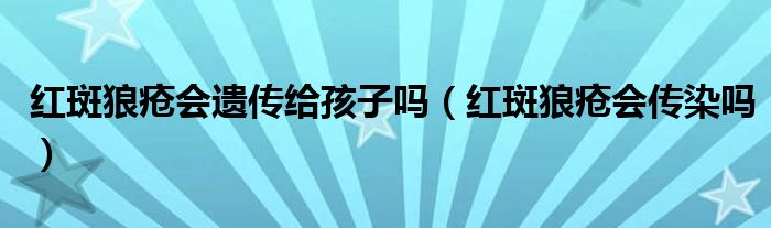 紅斑狼瘡會(huì)遺傳給孩子嗎(紅斑狼瘡會(huì)傳染嗎)