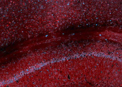 科學(xué)家利用血液測試來追蹤大腦中的基因表達(dá)