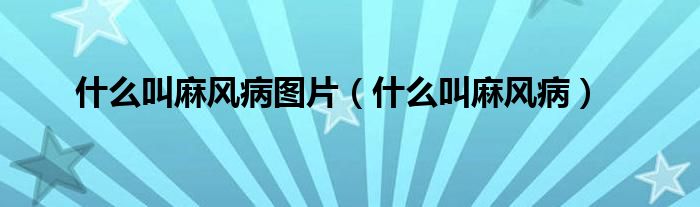 什么叫麻風(fēng)病圖片（什么叫麻風(fēng)?。?class='thumb lazy' /></a>
		    <header>
		<h2><a  href=