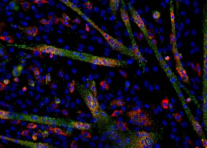 研究將自閉癥與 micro-RNA 的變化聯(lián)系起來