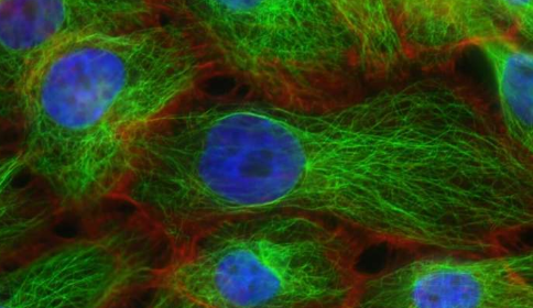 科學家研制出針對惡性乳腺癌的定制藥物