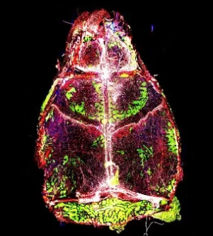 腦膜炎改變了小鼠腦內的免疫細胞組成